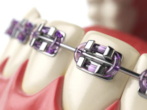 orthodontics